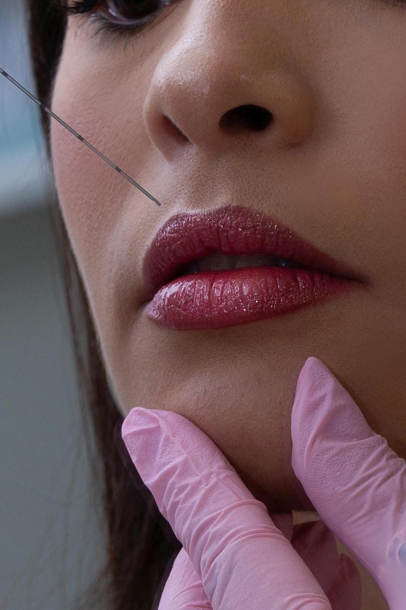 Lip enhancement