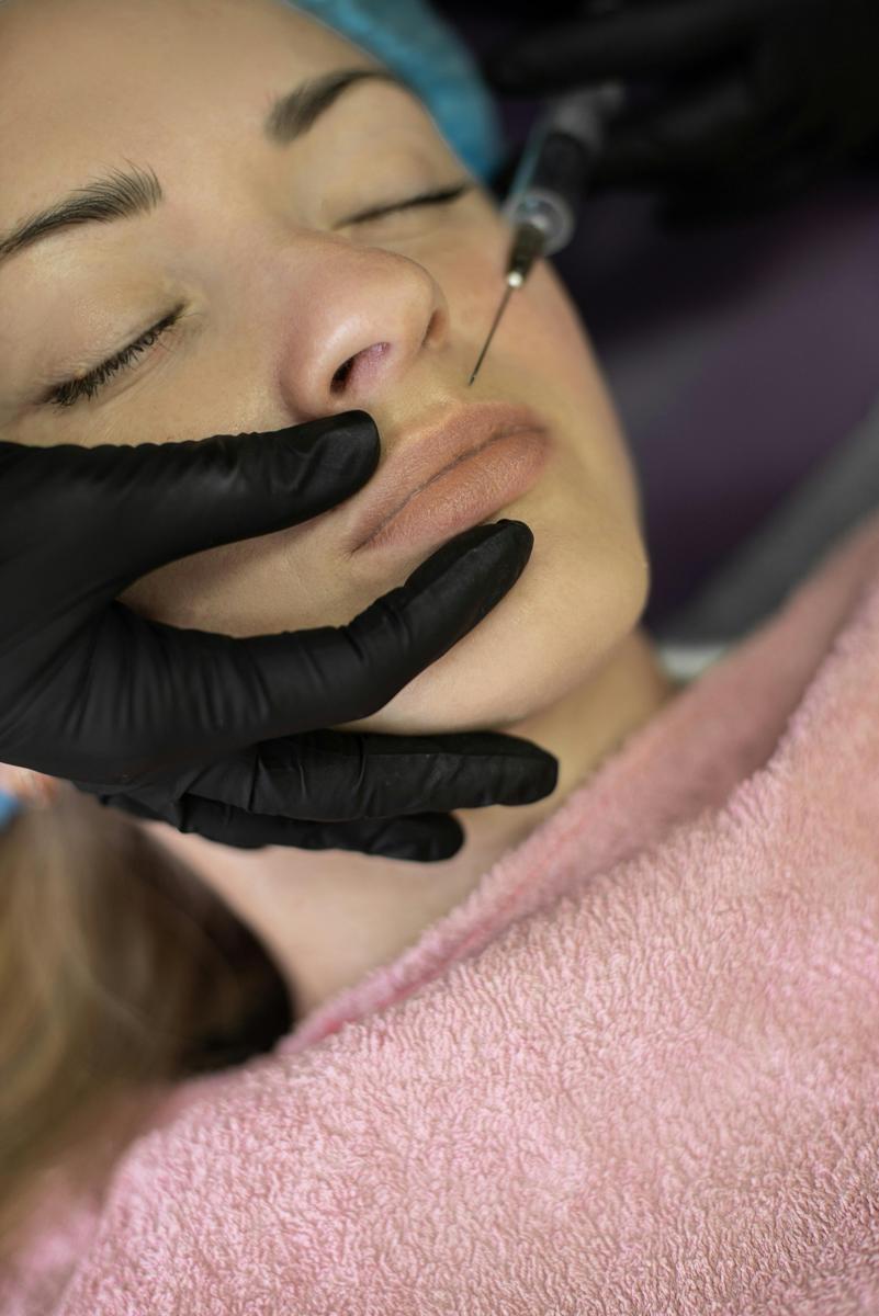 Lip filler