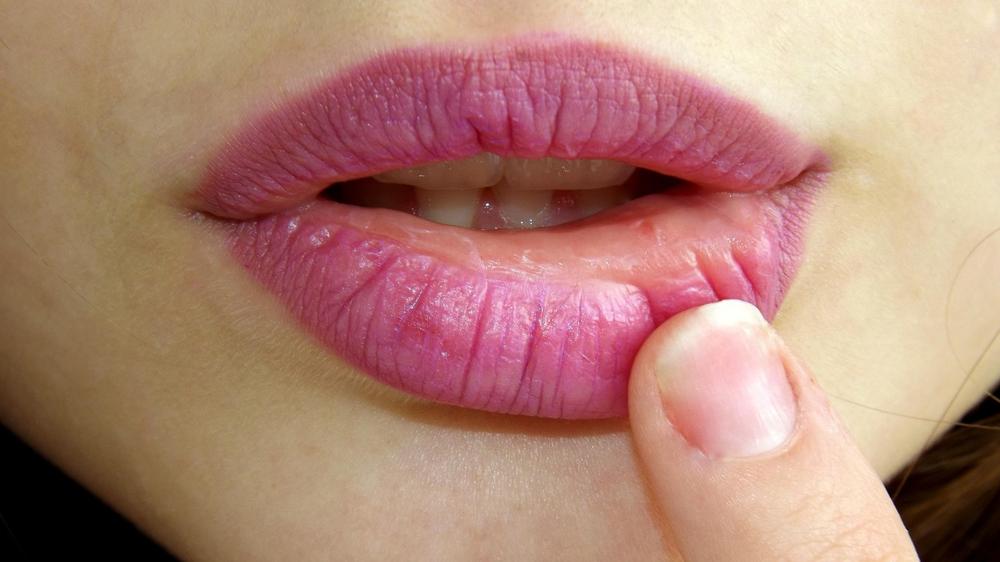 Lip filler