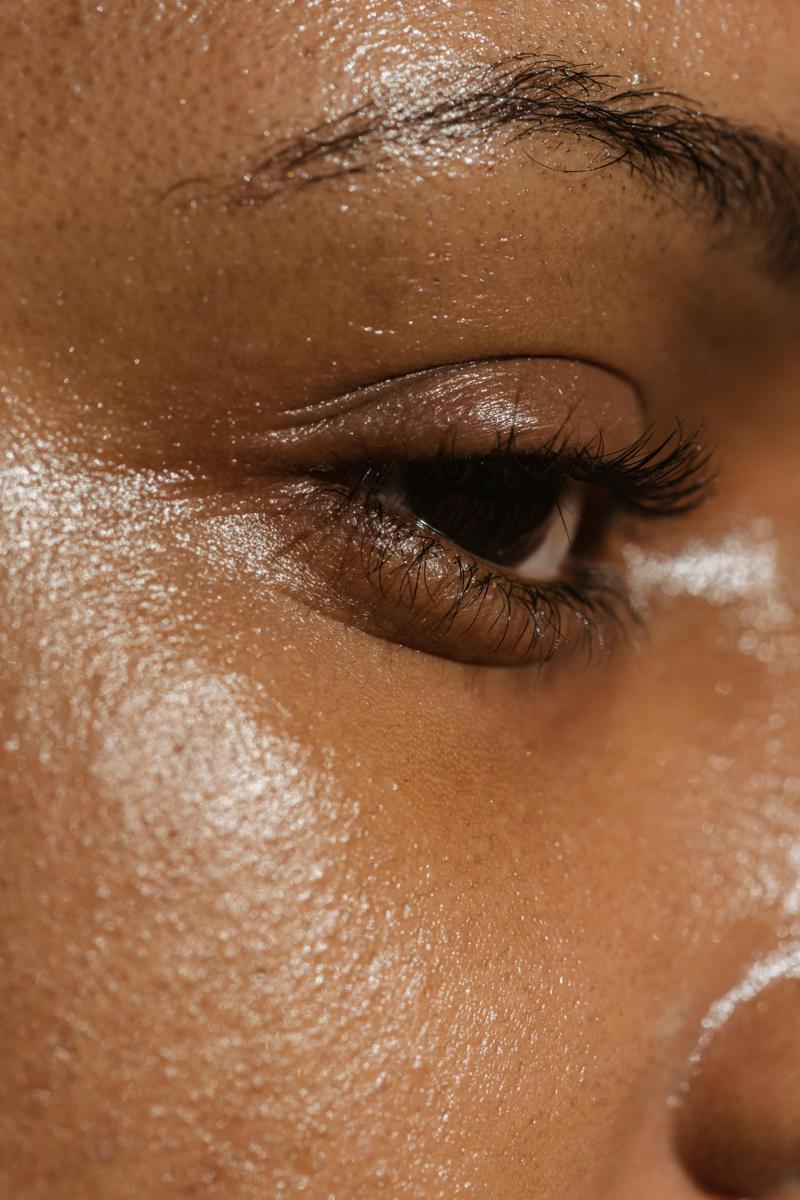 Skin analysis
