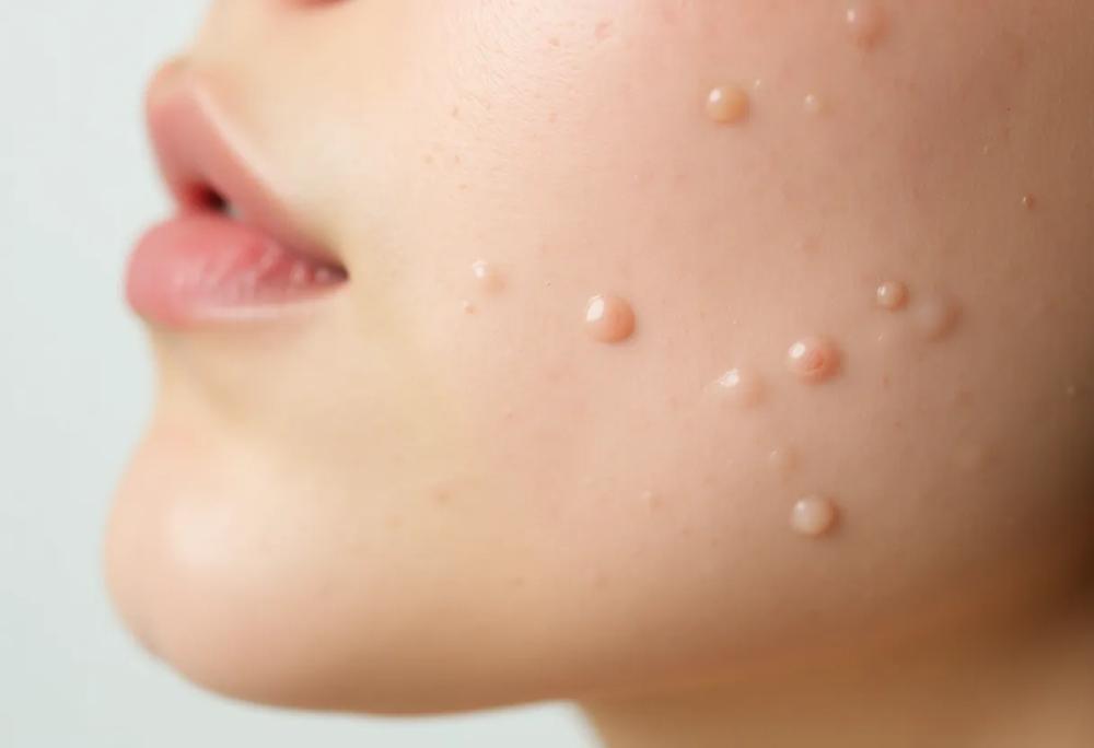 Skin texture
