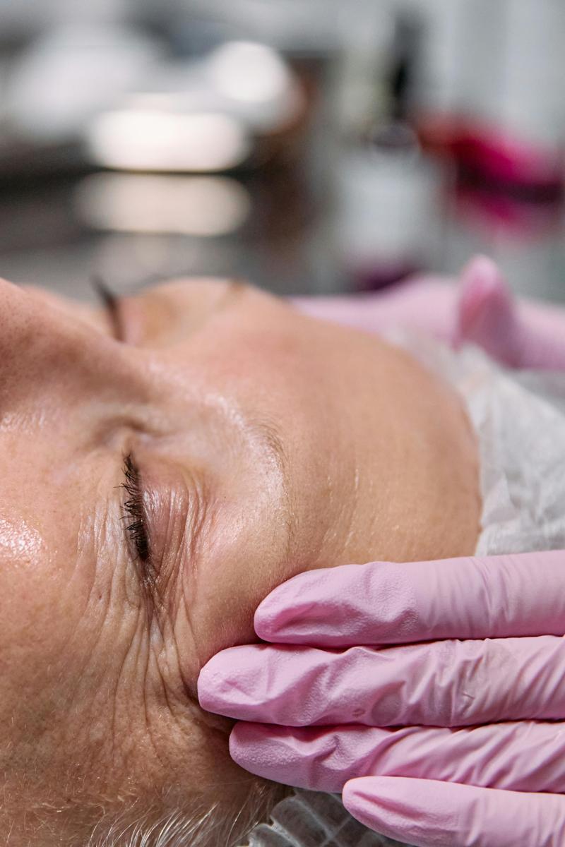 eye rejuvenation